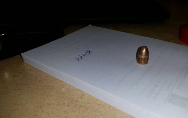 Une balle extraite du crâne d'une femme victime de tirs à Jérusalem, le 11 juillet 2016 (Crédit : Hadar Elboim/Hadassah Hospital) Une balle extraite du crâne d'une femme victime de tirs à Jérusalem, le 11 juillet 2016 (Crédit : Hadar Elboim/Hadassah Hospital)