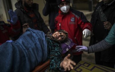 Un Syrienne blessée à Alep peut être soignée dans un hôpital syrien à la frontière turque, le 16 décembre 2016. (Crédit : Bulent Kilic/AFP)