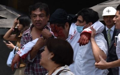 Un homme blessé après un séisme qui a touché Mexico et fait au moins 224 morts dans le centre du Mexique, le 19 septembre 2017. (Crédit : Kevin Chrisman/AFP)