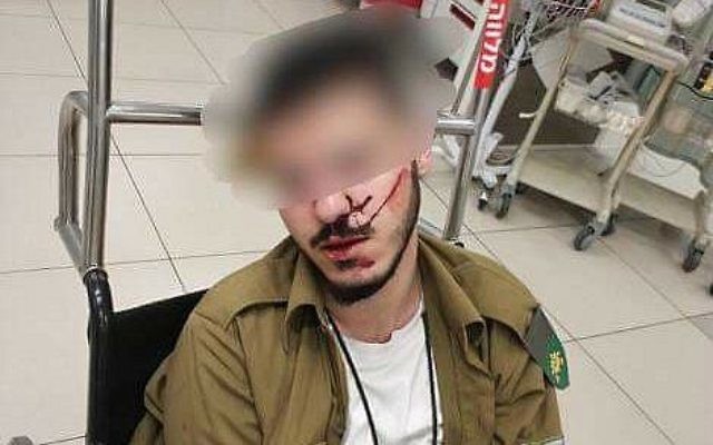 Un soldat druze agressé et battu par d'autres soldats à l'hôpital  (Crédit  : Facebook)