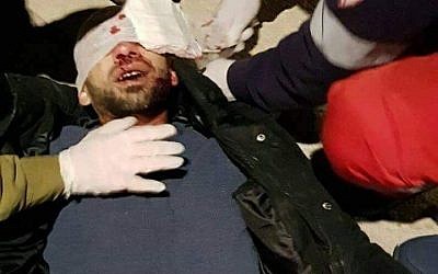 Un Palestinien reçoit des soins médicaux de la part des soldats israéliens après avoir reçu une pierre jetée par des habitants d'implantation à la tête, près de l'entrée de Naplouse, le 5 février 2018 (Autorisation)
