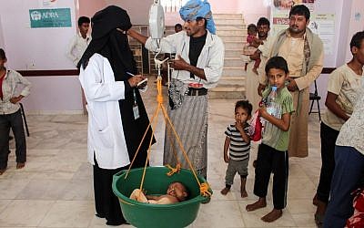 Un enfant yéménite souffrant de malnutrition est pesé dans un hôpital de la province du nord Hajjah, dans le quartier d'Abs, le  19 septembre 2018  (Crédit : . / AFP PHOTO)