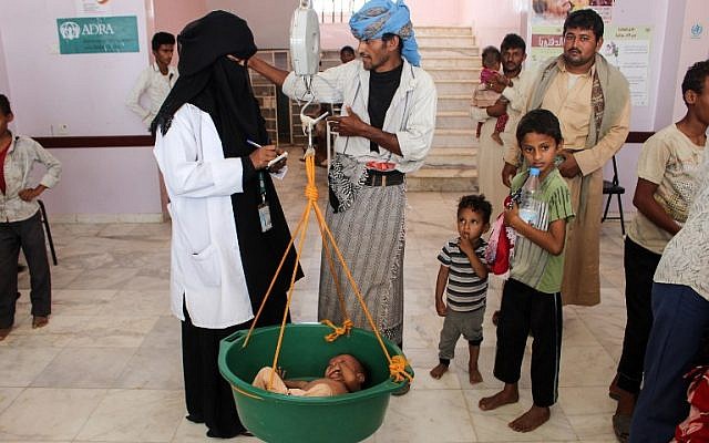 Un enfant yéménite souffrant de malnutrition est pesé dans un hôpital de la province du nord Hajjah, dans le quartier d'Abs, le  19 septembre 2018  (Crédit : . / AFP PHOTO)