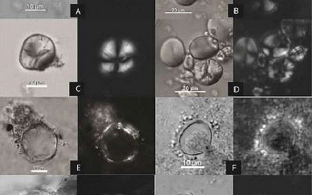Des traces microscopiques d'amidon ancien dans la grotte de Raqefet à gauche) comparées aux références de la professeure  Li Liu et de sa recherche dans ses expérimentations sur la préparation de la bière (Crédit: Li Liu)