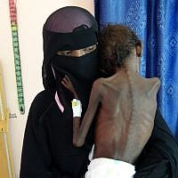 Une femme yéménite Nadia Nahari porte son fils de 5 ans Abdelrahman Manhash, souffrant de malnutrition sévère, à l'hoital de Khokha au Yemen., (Crédit : AFP) Une femme yéménite Nadia Nahari porte son fils de 5 ans Abdelrahman Manhash, souffrant de malnutrition sévère, à l'hoital de Khokha au Yemen., (Crédit : AFP)
