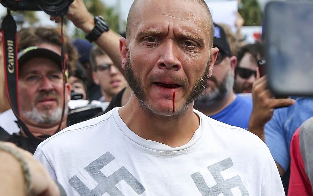 Le sang coule de la lèvre d'un homme portant un tee-shirt avec des croix gammées après avoir été frappé par un manifestant devant un auditorium de l'Université de Floride où le nationaliste blanc Richard Spencer se préparait à parler, le jeudi 19 octobre 2017 à Gainesville, en Floride. (Will Vragovic/Tampa Bay Times via AP) Le sang coule de la lèvre d'un homme portant un tee-shirt avec des croix gammées après avoir été frappé par un manifestant devant un auditorium de l'Université de Floride où le nationaliste blanc Richard Spencer se préparait à parler, le jeudi 19 octobre 2017 à Gainesville, en Floride. (Will Vragovic/Tampa Bay Times via AP)