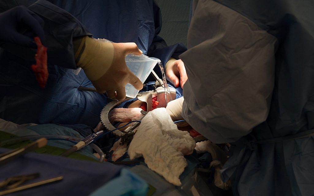 Sur cette photo prise le 28 juin 2016, le Dr Matthew Cooper, (à gauche), et le Dr Seyed Ghasemian, transplantent un rein donné à Brenda Hudson au MedStar Georgetown University Hospital à Washington. (AP Photo/Molly Riley)