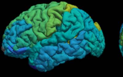 La nouvelle technique d'IRM développée par des chercheurs de l'Université hébraïque de Jérusalem fournit aux utilisateurs une carte moléculaire des différentes zones du cerveau (Shir Filo/ Université hébraïque) Illustration.