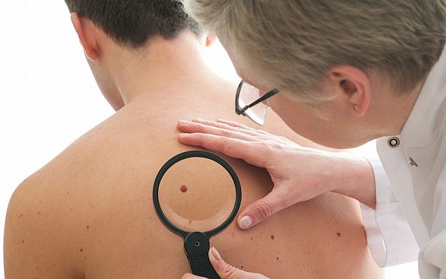 Image d'un dermatologue qui vérifie un grain de beauté d'un patient pour détecter des signes d'un mélanome. (AlexRaths; iStock par Getty Images) Image d'un dermatologue qui vérifie un grain de beauté d'un patient pour détecter des signes d'un mélanome. (AlexRaths; iStock par Getty Images)