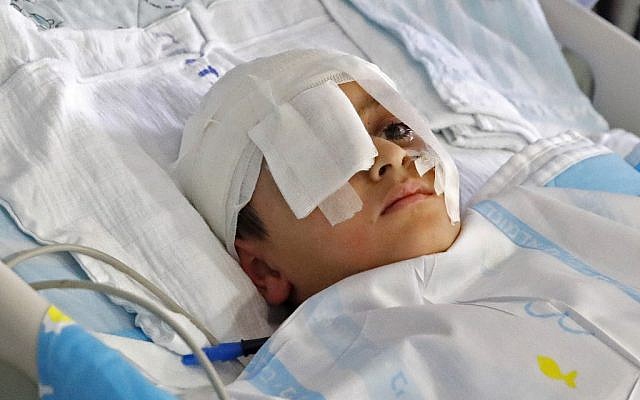 Abdelrahman Shtewi, dans un lit d'hôpital à Sheba, à Ramat Gan, le 12 août 209. Le jeune garçon a été blessé par une balle israélienne à Gaza. (Crédit : JACK GUEZ / AFP) Abdelrahman Shtewi, dans un lit d'hôpital à Sheba, à Ramat Gan, le 12 août 209. Le jeune garçon a été blessé par une balle israélienne à Gaza. (Crédit : JACK GUEZ / AFP)