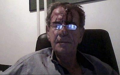 Tob Cohen, un juif hollandais, après un combat avec sa femme en 2019, à proximité de Nairobi, au Kenya. (Crédit : JTA)
