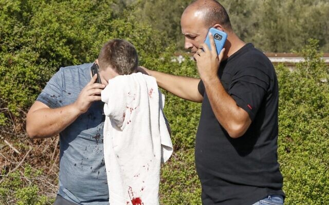 Un homme essuie le sang de son visage après avoir été blessé sur une autoroute de la ville d'Ashdod, le 12 novembre 2019. (Crédit : JACK GUEZ / AFP)