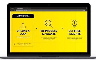 La technologie d'analyse de scan Zebra de Medical Vision en action (Crédit).