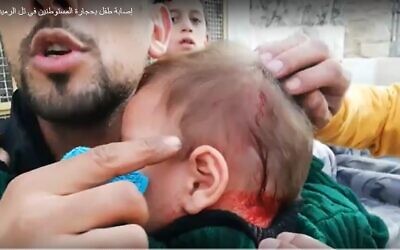 Un bébé blessé par des jets de pierre lancés par des habitants extrémistes d'implantations israéliennes à Hébron (Capture d'écran : YouTube)