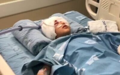 Un garçon de neuf ans blessé à la tête par une balle au bout en mousse durant une opération de police à Issawiya, le 16 février 2020. (Capture d'écran : Treizième chaîne) Un garçon de neuf ans blessé à la tête par une balle au bout en mousse durant une opération de police à Issawiya, le 16 février 2020. (Capture d'écran : Treizième chaîne)