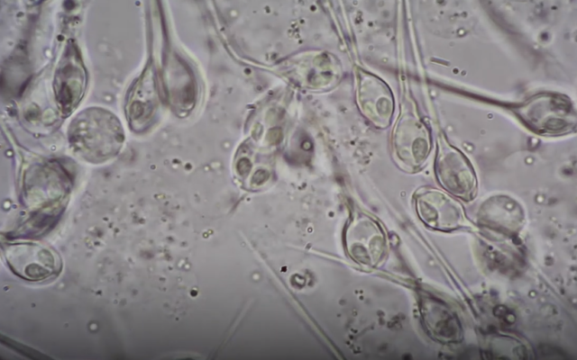 L'Henneguya salminicola observée au microscope. (Capture d'écran : YouTube) L'Henneguya salminicola observée au microscope. (Capture d'écran : YouTube)