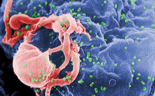 Micrographie électronique du VIH-1 naissabt (en vert) à partir d'une culture de lymphocytes . Cette image a été colorée pour mettre en évidence des caractéristiques importantes (Photo: domaine public / Wikimedia Commons,  Centers for Disease Control and Prevention's Public Health Image Library)