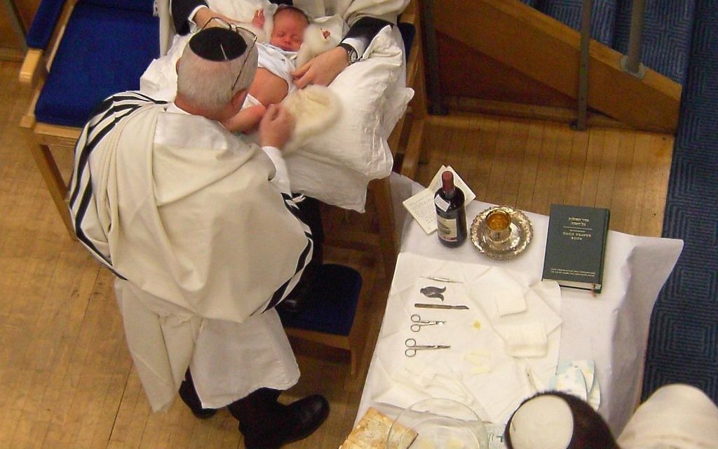 Illustration : Une cérémonie de brit mila, la circoncision rituelle. (Crédit : Cheskel Dovid/CC BY 3.0/Wikimedia Commons) Illustration : Une cérémonie de brit mila, la circoncision rituelle. (Crédit : Cheskel Dovid/CC BY 3.0/Wikimedia Commons)