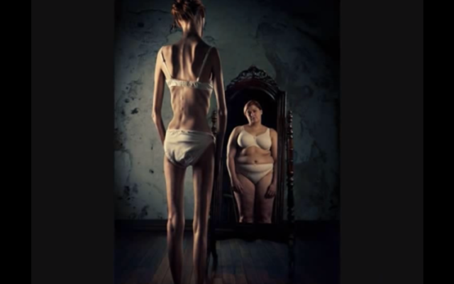 Illustration d'une femme anorexique devant le miroir (Crédit : capture d’écran YouTube)
