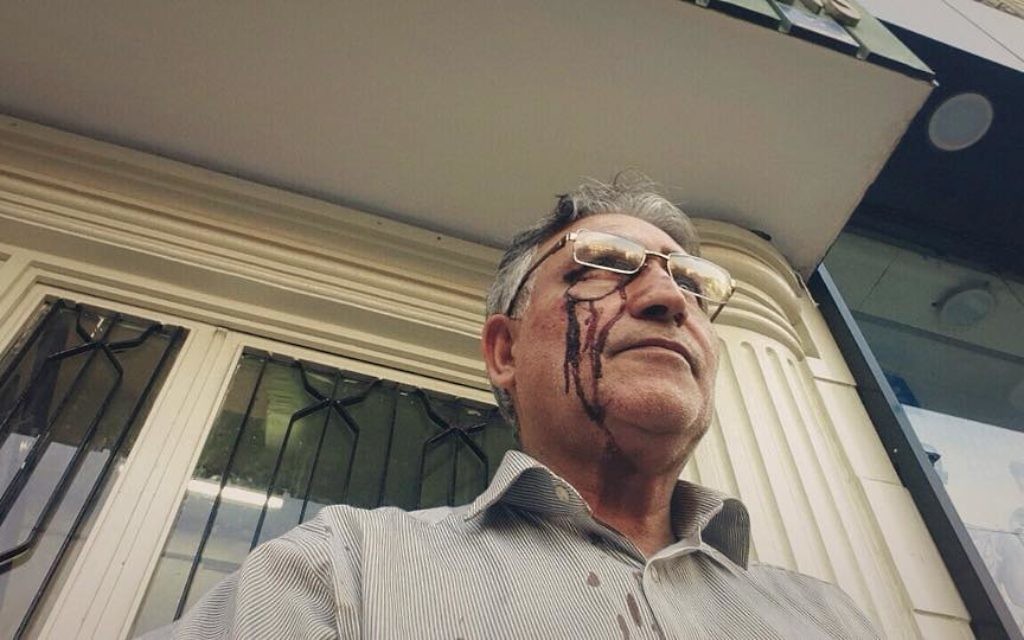 Mohammad Nourizad, le visage ensanglanté, après avoir protesté devant le domicile du guide suprême de l'Iran, Ali Khameni, le 14 octobre 2014. (Crédit : Autorisation Abazar Noorizad) Mohammad Nourizad, le visage ensanglanté, après avoir protesté devant le domicile du guide suprême de l'Iran, Ali Khameni, le 14 octobre 2014. (Crédit : Autorisation Abazar Noorizad)