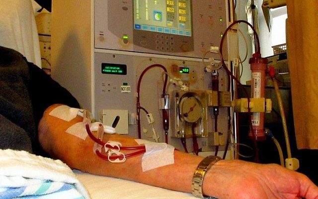 Un patient sous dialyse. Illustration. (Crédit : Anna Frodesiak/Wikimedia Commons)