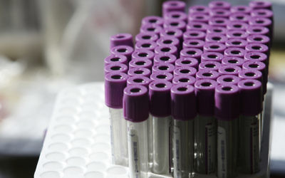Tubes à essai pour des tests sanguins. Illustration. (Crédit : Kobi Gideon/Flash90)