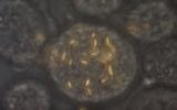 Des Nanotiges en or à l'intérieur d'une cellule (Crédit : Capture d'écran YouTube)