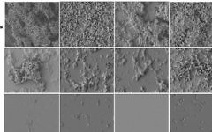Les surfaces contrôles, non traitées, montre une colonisation bactérienne dense (en haut), alors que le revêtement FMC-Cu empêche la formation de biofilm, en bas. (Crédit : autorisation)