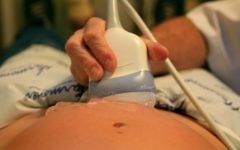 Echographie d'une femme enceinte à Tel Aviv, le 3 novembre 2009 (Crédit  : Chen Leopold / Flash 90)
