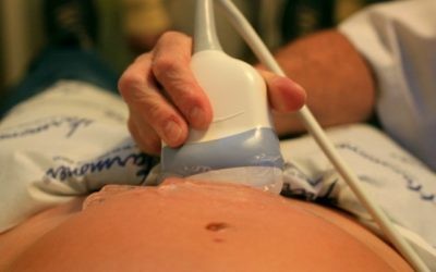 Echographie d'une femme enceinte à Tel Aviv, le 3 novembre 2009 (Crédit  : Chen Leopold / Flash 90)