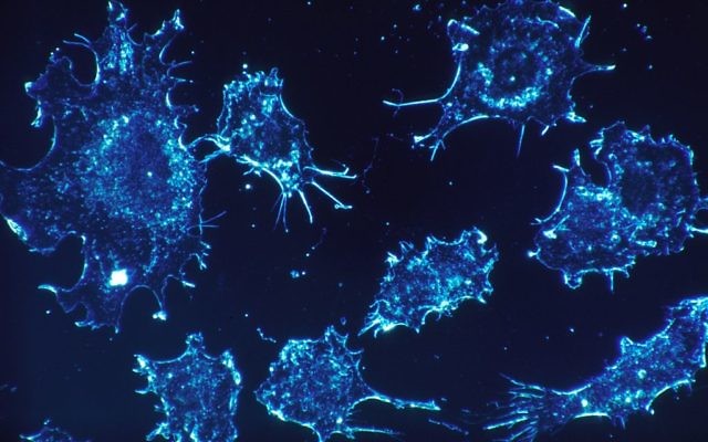 Cellules cancéreuses. Illustration. (Crédit : Pixabay)