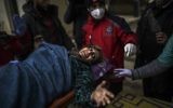 Un Syrienne blessée à Alep peut être soignée dans un hôpital syrien à la frontière turque, le 16 décembre 2016. (Crédit : Bulent Kilic/AFP)