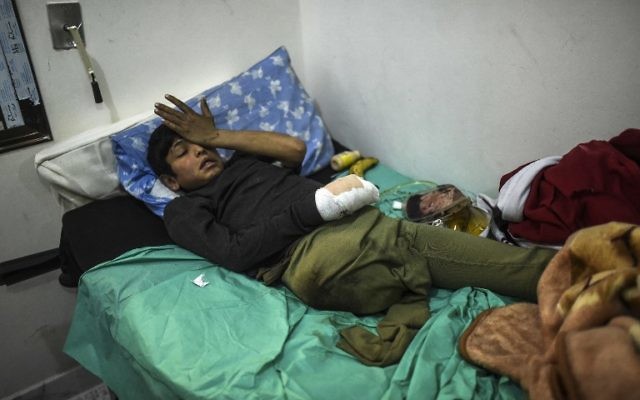 Un garçon syrien blessé à Alep peut être soigné dans un hôpital syrien à la frontière turque, le 16 décembre 2016. (Crédit : Bulent Kilic/AFP)