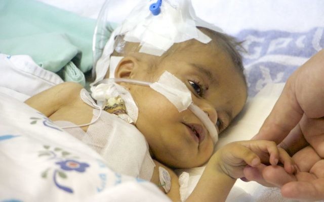 Yacub, un petit garçon de deux ans, tient la main du chirurgien cardiaque israélien qui lui a sauvé la vie (Crédit : Dov Lieber/Times of Israel)