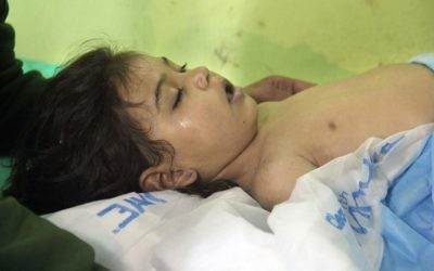 Un enfant syrien inconscient à l'hôpital de Khan Sheikhun, une ville tenue par les rebelles de la province d'Idleb, après une attaque au gaz toxique, le 4 avril 2017. (Crédit : Omar Haj Kadour/AFP)