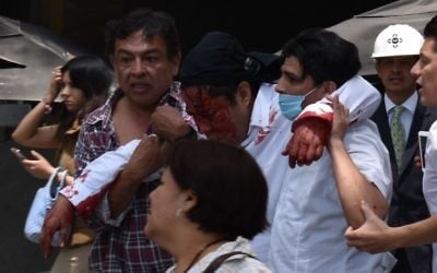 Un homme blessé après un séisme qui a touché Mexico et fait au moins 224 morts dans le centre du Mexique, le 19 septembre 2017. (Crédit : Kevin Chrisman/AFP)