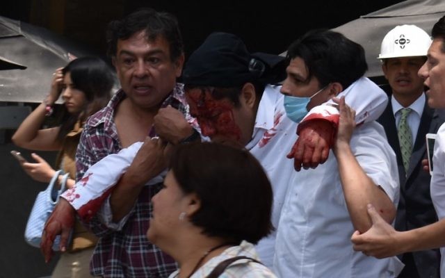 Un homme blessé après un séisme qui a touché Mexico et fait au moins 224 morts dans le centre du Mexique, le 19 septembre 2017. (Crédit : Kevin Chrisman/AFP)