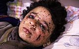 Le jeune Omar, âgé de dix ans, blessé lors d'une frappe aérienne qui a tué plusieurs membres de sa famille à Otaybah, chez eux, est soigné dans un hôpital de fortune situé dans l'enclave rebelle de Ghouta Est, en Syrie, le 25 février 2018. (AFP PHOTO / AMER ALMOHIBANY)