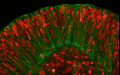 Capture d'écran d'images en accéléré montrant le développement d'un organoïde de cerveau incorporant la mutation génique à l'origine du syndrome du cerveau lisse (Capture d'écran : YouTube)