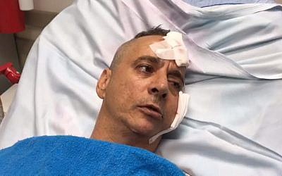 Aharon Bucharis se souvient du moment où son domicile de Sdérot a été frappé par une roquette, le 14 juillet 2018 (Capture d'écran : Autorisation du porte-parole de l'hôpital Barzilai)
