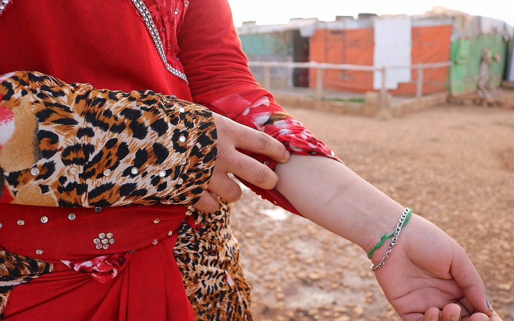 Salwa montre la cicatrice qu'elle a sur le poignet, un souvenir de l'une des nombreuses fois où elle a tenté de se suicider après avoir été forcée d'épouser un homme violent à l'âge de 14 ans (Crédit : Lisa Khoury/ Times of Israel)