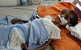Un enfant yéménite souffrant de malnutrition est soigné dans un hôpital de la province du nord Hajjah, dans le quartier d'Abs, le  19 septembre 2018  (Crédit : . / AFP PHOTO)