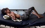 Ghazi Saleh, 8 kilos pour 10 ans, dans un lit d'hôpital de Taez au Yémén, le 19 novembre 2018. (Crédit : Marzooq AL-JABIRY / AFP)