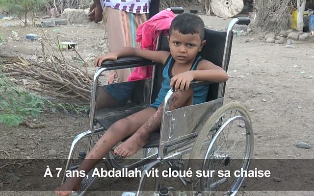 Au Yémen, Abdallah, un enfant de 7 ans victime des mines. (Crédit : Capture d'écran AFPTV via YouTube) Au Yémen, Abdallah, un enfant de 7 ans victime des mines. (Crédit : Capture d'écran AFPTV via YouTube)