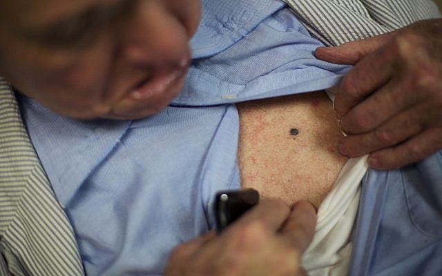 Photo d'illustration : John Jay Hooker montre un mélanome qui a rétréci depuis le début de son traitement au service d'oncologie de Nashville, dans le Tennessee, le 27 août 2015 (Crédit : AP Photo/David Goldman) Photo d'illustration : John Jay Hooker montre un mélanome qui a rétréci depuis le début de son traitement au service d'oncologie de Nashville, dans le Tennessee, le 27 août 2015 (Crédit : AP Photo/David Goldman)