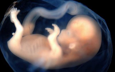 Image d'un foetus humain de 9-10 semaines. (Flickr/ caustique lunaire /CC BY-SA)