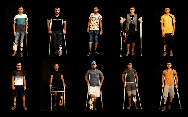 Dans cette combinaison de 10 photos prises le 10 septembre 2018, des Palestiniens blessés à la jambe pendant les manifestations et les émeutes à la frontière avec Israël attendent un traitement dans un hôpital de Gaza City exploité par Médecins sans frontières (MSF) (Crédit : AP Photo/Felipe Dana) Dans cette combinaison de 10 photos prises le 10 septembre 2018, des Palestiniens blessés à la jambe pendant les manifestations et les émeutes à la frontière avec Israël attendent un traitement dans un hôpital de Gaza City exploité par Médecins sans frontières (MSF) (Crédit : AP Photo/Felipe Dana)