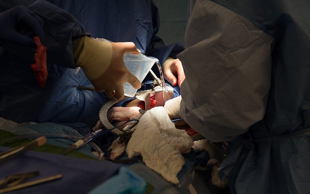Sur cette photo prise le 28 juin 2016, le Dr Matthew Cooper, (à gauche), et le Dr Seyed Ghasemian, transplantent un rein donné à Brenda Hudson au MedStar Georgetown University Hospital à Washington. (AP Photo/Molly Riley)