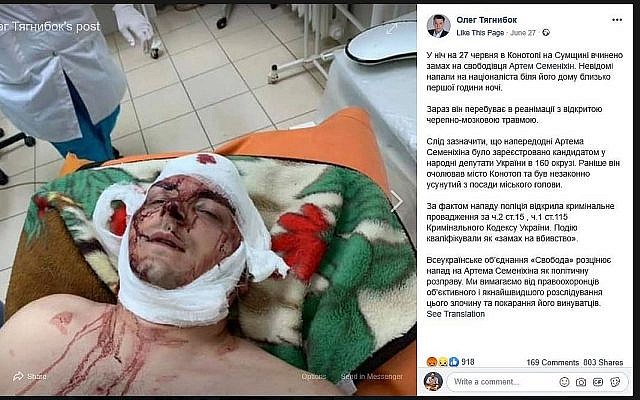 Artem Semenikhin, un politicien ukrainien agressé à Konotop. (Crédit : Facebook) Artem Semenikhin, un politicien ukrainien agressé à Konotop. (Crédit : Facebook)