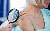 Image d'un dermatologue qui vérifie un grain de beauté d'un patient pour détecter des signes d'un mélanome. (Crédit : iStock par Getty Images)